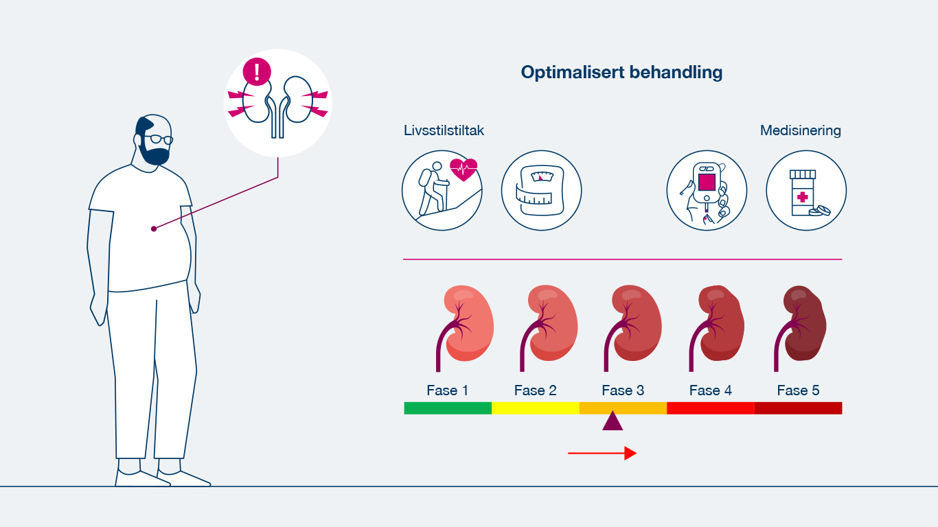 AZ_Veileder_CKD-Tiltak_illustrasjon-behandling.png