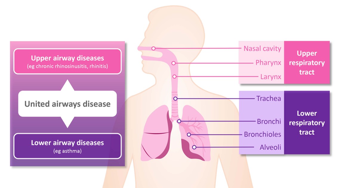 Picture united airways.jpg