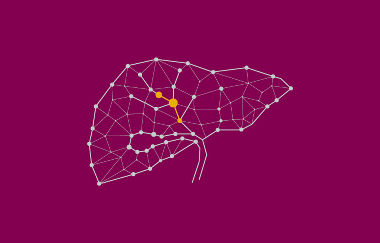 illustration av en lever med gul punktmarkering som representerar gallvägscancer.