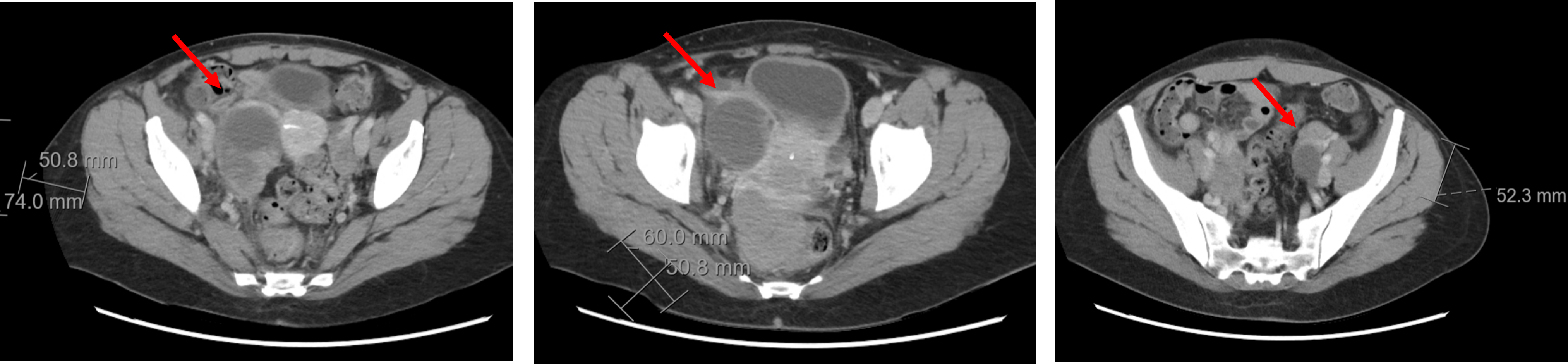 radiologi.png